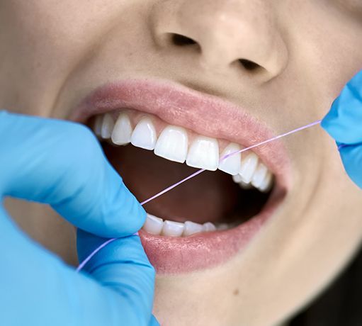 Patient getting teeth flossed.